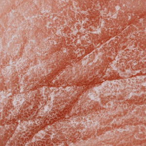 Arganolie gebruiken om eczeem te verminderen